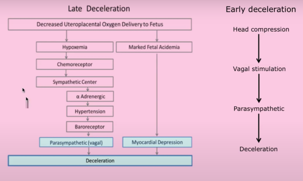 Pathophysiology of late deceleration vs early deceleration. Late deceleration has a lag time to become hypoxic