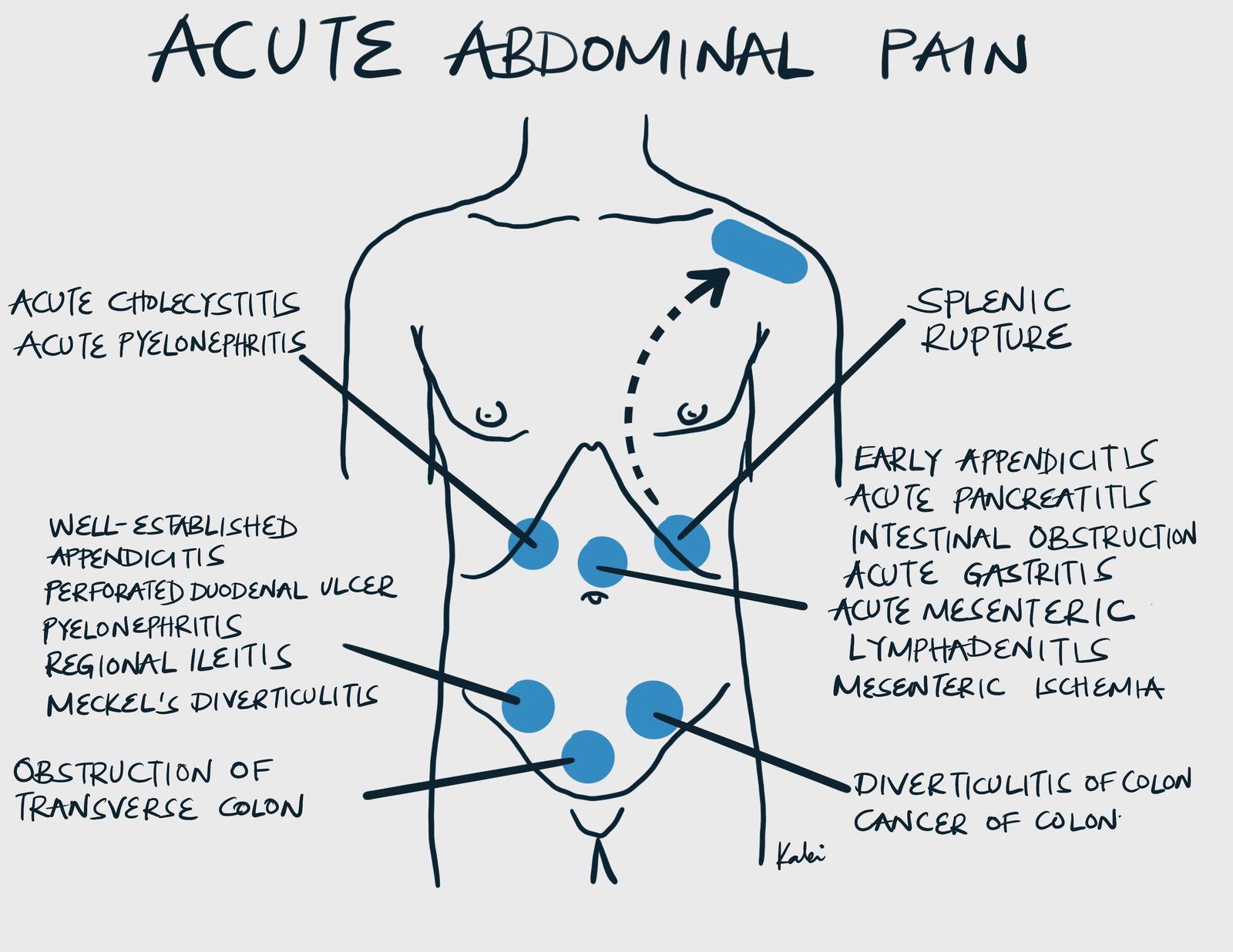 acute-abdominal-pain-hyperexcision