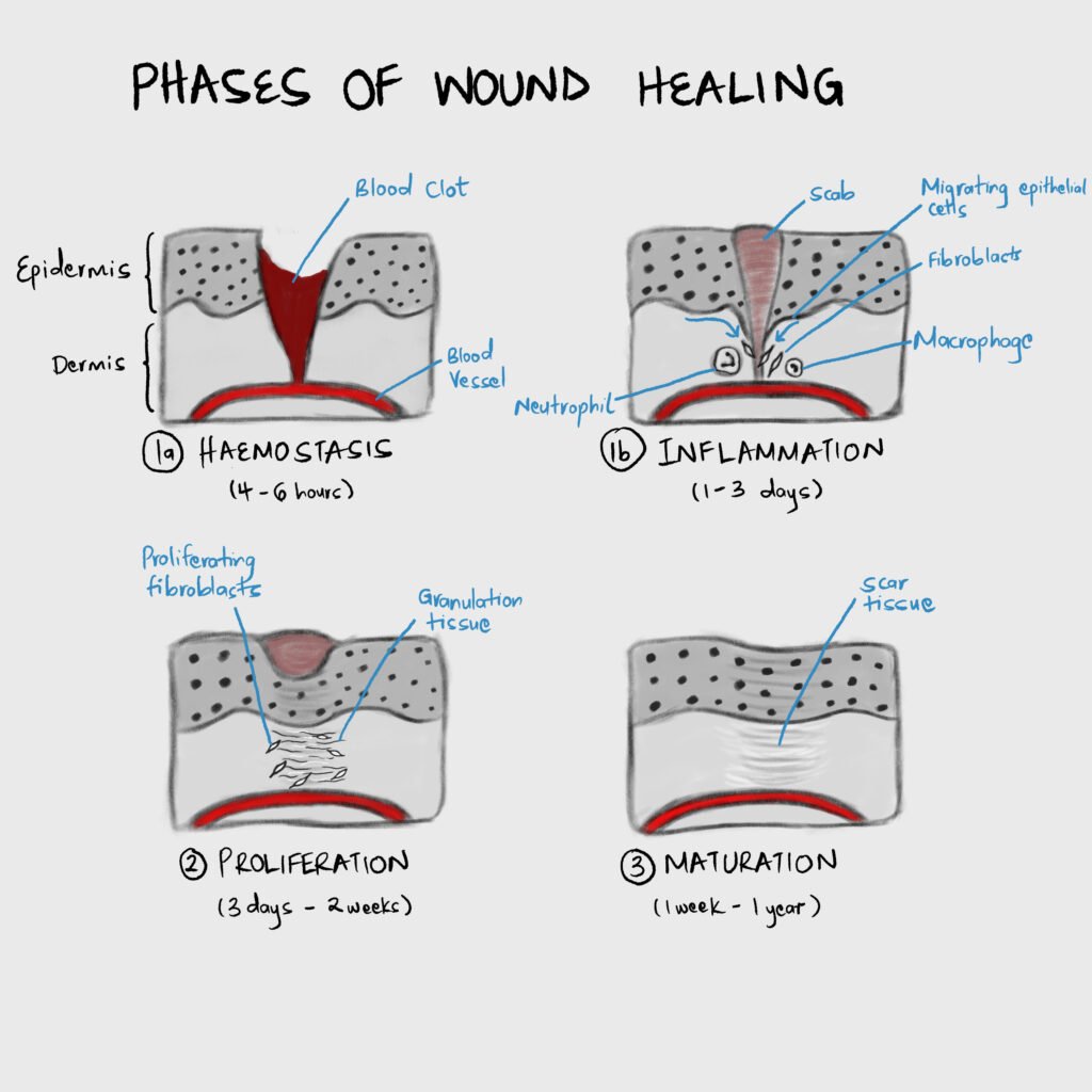 Phases of wound healing