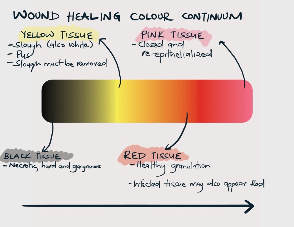Wound healing colour continuum