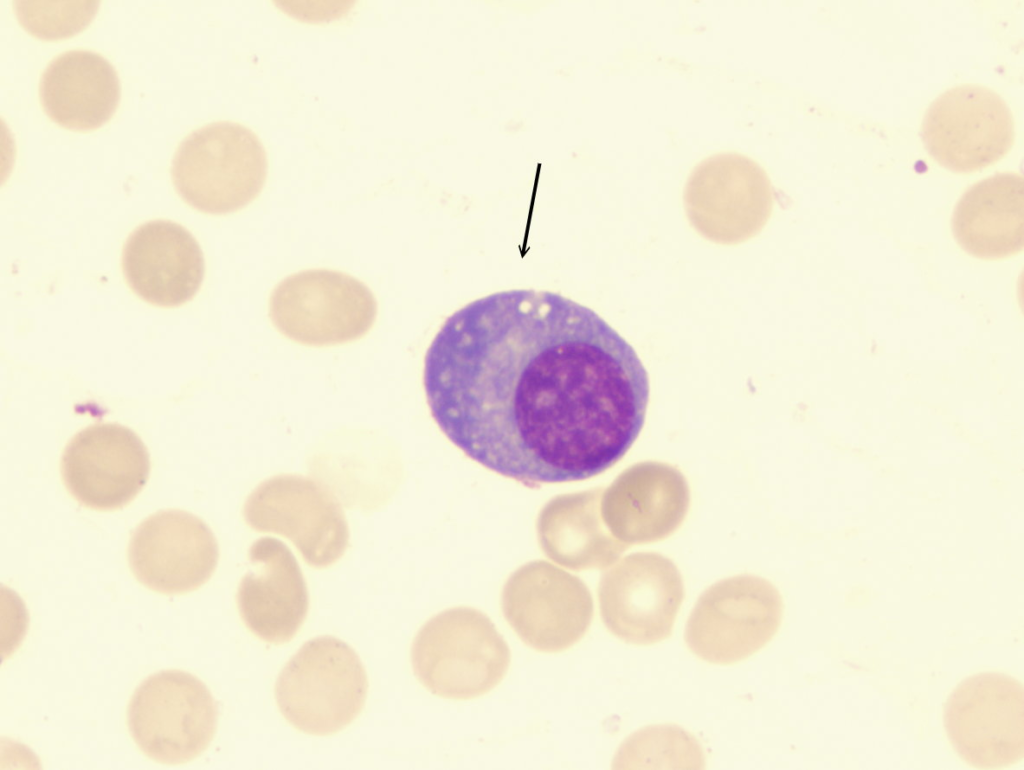 Normal Plasma Cell