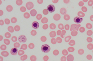 Basophilic stippling