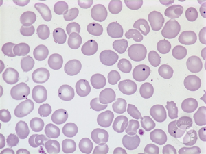 Howel-jolly bodies