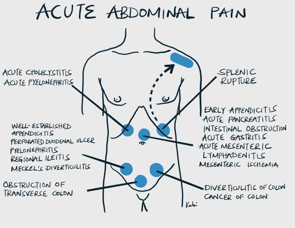 Acute Abdominal Pain Hyperexcision acute-abdominal-pain-hyperexcision