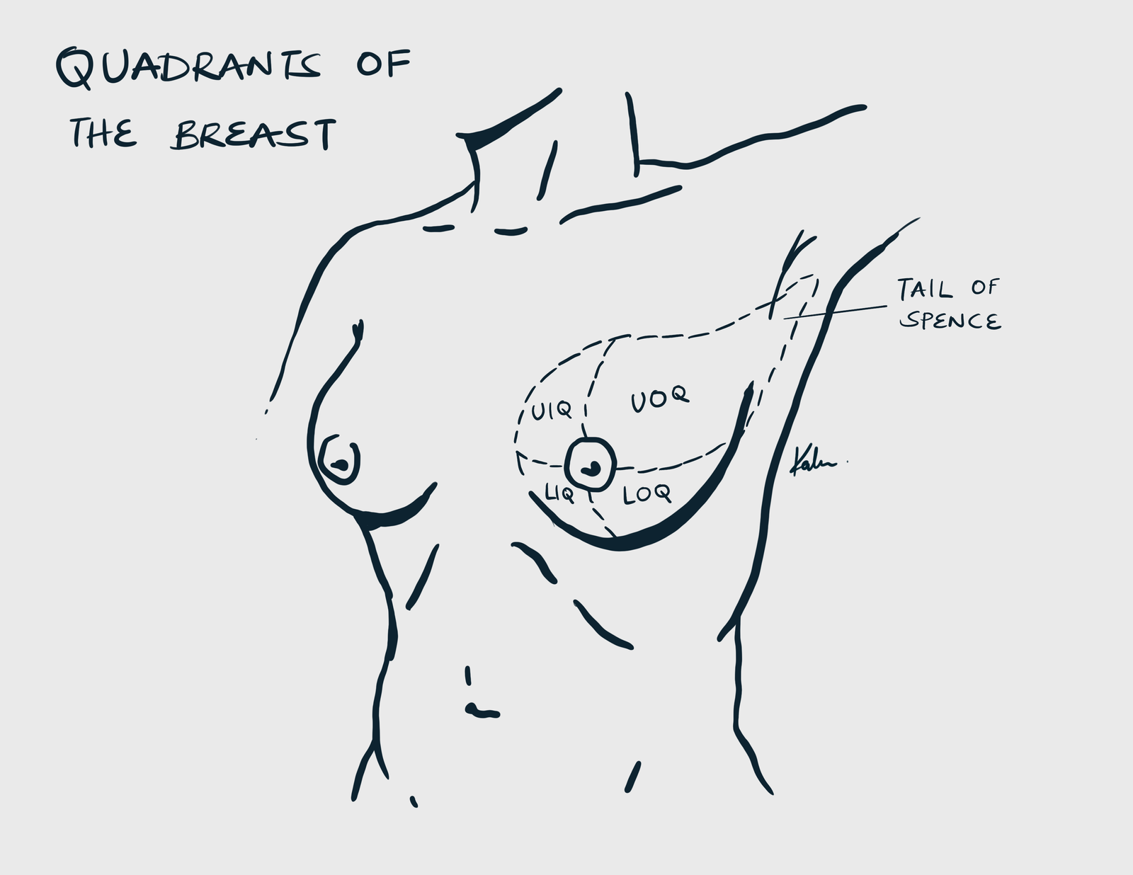 Quadrants of the breast