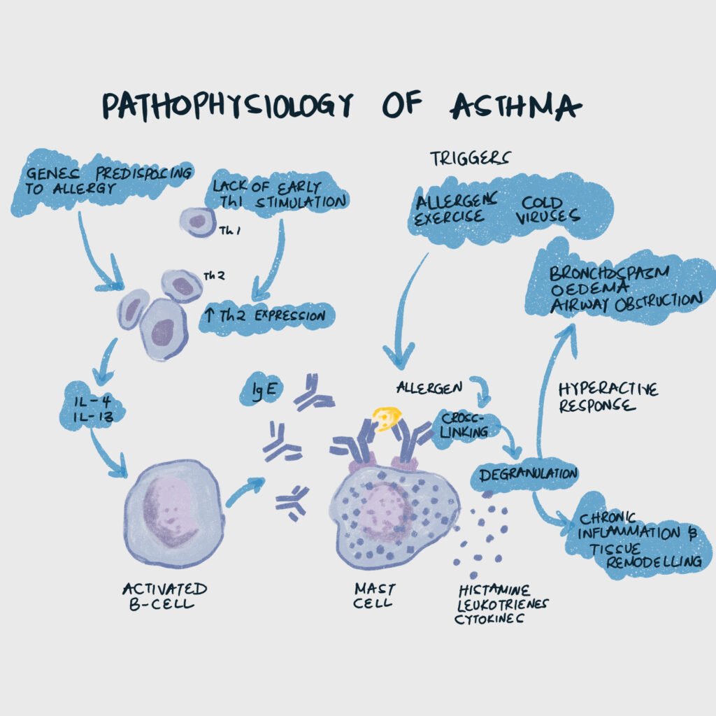 Pathophysiology of Asthma