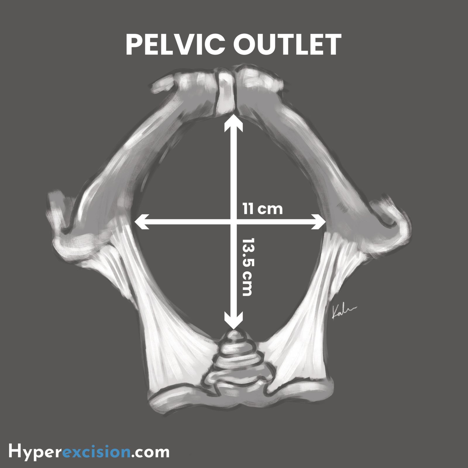 Pelvic Assessment and Cephalopelvic Disproportion (CPD) - Hyperexcision